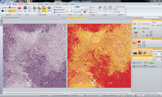 Analyze Nuclei or Cell Population Characteristics with Smart Segmentation